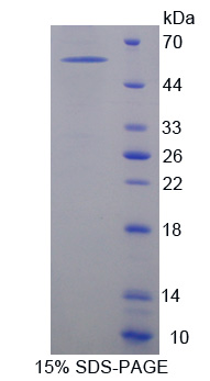 Recombinant Activated Leukocyte Cell Adhesion Molecule (ALCAM)