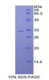 Recombinant Activated Leukocyte Cell Adhesion Molecule (ALCAM)