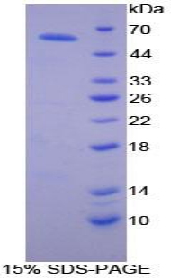 Recombinant Activated Leukocyte Cell Adhesion Molecule (ALCAM)