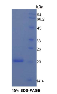 Recombinant Angiopoietin 1 (ANGPT1)