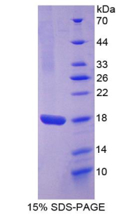 Recombinant Angiopoietin 2 (ANGPT2)