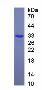 Recombinant Brain Derived Neurotrophic Factor (BDNF)