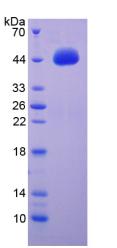 Recombinant Brain Derived Neurotrophic Factor (BDNF)