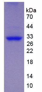 Recombinant Brain Derived Neurotrophic Factor (BDNF)