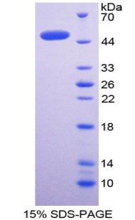 RPA014Hu02.jpg