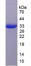 Recombinant E-cadherin