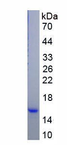 Recombinant Interleukin 8 Receptor Alpha (IL8Ra)