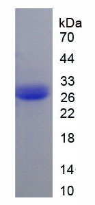 Recombinant Ciliary Neurotrophic Factor (CNTF)