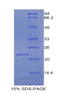 Recombinant Endothelial protein C receptor (EPCR)