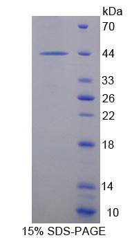 Recombinant Endocrine Gland Derived Vascular Endothelial Growth Factor (EG-VEGF)