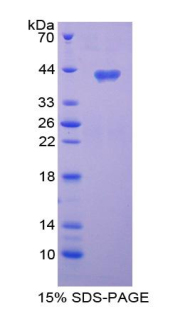 Recombinant Chemokine C-C-Motif Ligand 3 Like Protein 1 (CCL3L1)