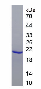 Recombinant Erythropoietin Receptor (EPOR)