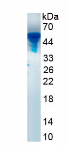 Recombinant Erythropoietin (EPO)