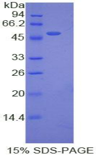 Recombinant Erythropoietin (EPO)