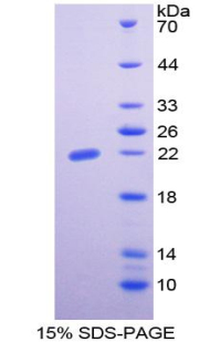 Recombinant Erythropoietin (EPO)