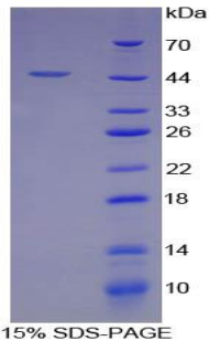 Recombinant E-selectin