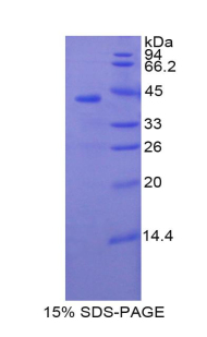 Recombinant E-selectin