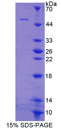 Recombinant Factor Related Apoptosis (FAS)