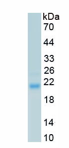 Recombinant Fibroblast Growth Factor 1, Acidic (FGF1)