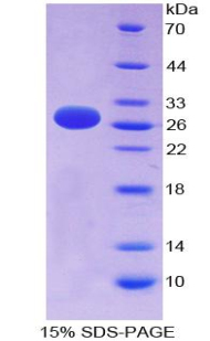 Recombinant FMS Like Tyrosine Kinase 3 (Flt3)