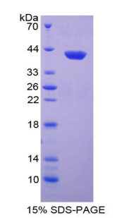 Recombinant Chemokine (C-X-C Motif) Ligand 1 (CXCL1)