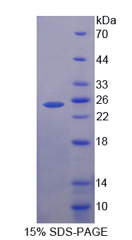 Recombinant Growth Hormone (GH)