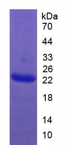 Recombinant Growth Hormone (GH)