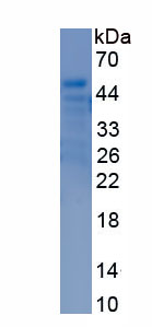 Recombinant Colony Stimulating Factor 2, Granulocyte Macrophage (GM-CSF)