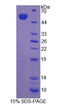 Recombinant Hepatocyte Growth Factor (HGF)