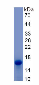 Recombinant Inhibin Beta E (INHbE)