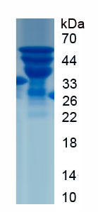 Recombinant Inhibin Beta E (INHbE)