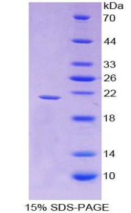 Recombinant Interferon Gamma (IFNg)