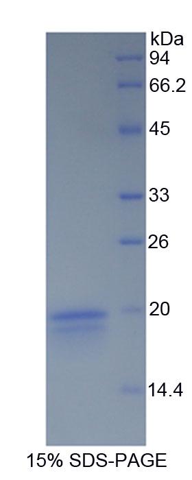 Recombinant Interferon Gamma (IFNg)