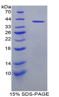 Recombinant Insulin Like Growth Factor 1 (IGF1)