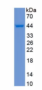 Recombinant Insulin Like Growth Factor 1 (IGF1)