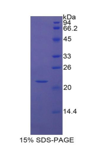 Recombinant Insulin Like Growth Factor Binding Protein 1 (IGFBP1)