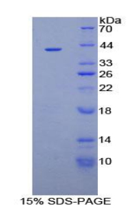 Recombinant Insulin Like Growth Factor Binding Protein 1 (IGFBP1)