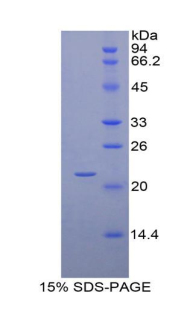 Recombinant Insulin Like Growth Factor Binding Protein 1 (IGFBP1)