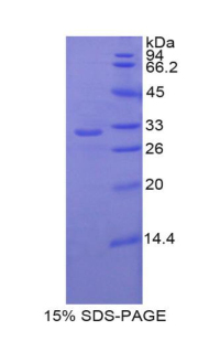 Recombinant Insulin Like Growth Factor Binding Protein 1 (IGFBP1)