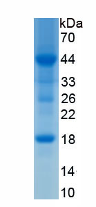 Recombinant Insulin Like Growth Factor Binding Protein 2 (IGFBP2)