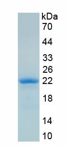 Recombinant Insulin Like Growth Factor Binding Protein 3 (IGFBP3)