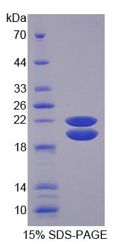 Recombinant Insulin Like Growth Factor Binding Protein 3 (IGFBP3)