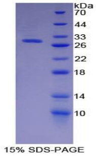 Recombinant Insulin Like Growth Factor Binding Protein 4 (IGFBP4)