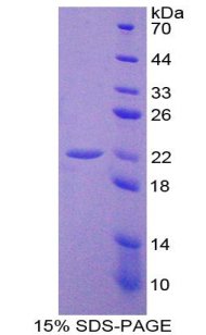 Recombinant Interleukin 10 (IL10)