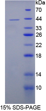 Recombinant Interleukin 12B (IL12B)