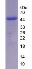 Recombinant Interleukin 17 (IL17)