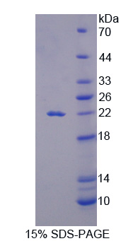 Recombinant Interleukin 18 (IL18)