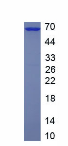 Recombinant Interleukin 1 Receptor Type II (IL1R2)