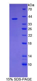 Recombinant Glial Fibrillary Acidic Protein (GFAP)