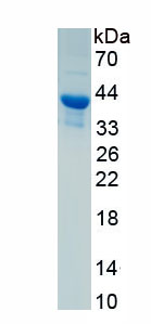 Recombinant Glial Fibrillary Acidic Protein (GFAP)